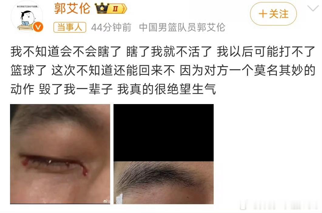 郭艾伦眼睛流血 打篮球到底有什么动作是需要把手指插入对方眼睛里[哆啦A梦害怕][