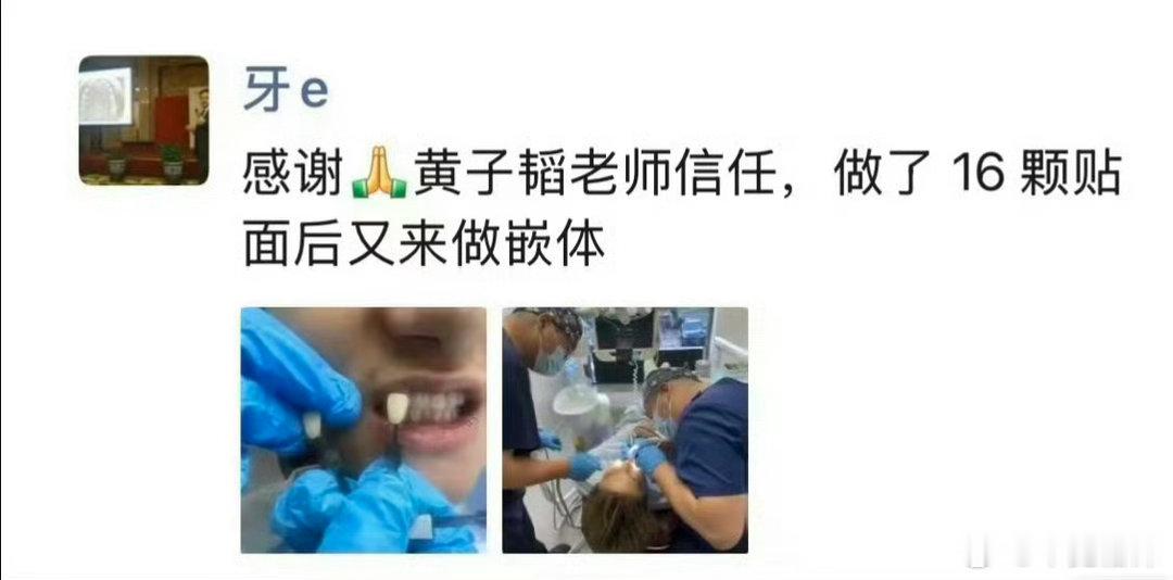 黄子韬怒斥偷拍牙医黄子韬看牙医被偷偷拍照发到朋友圈传播，这确实不冤枉，不经过消费