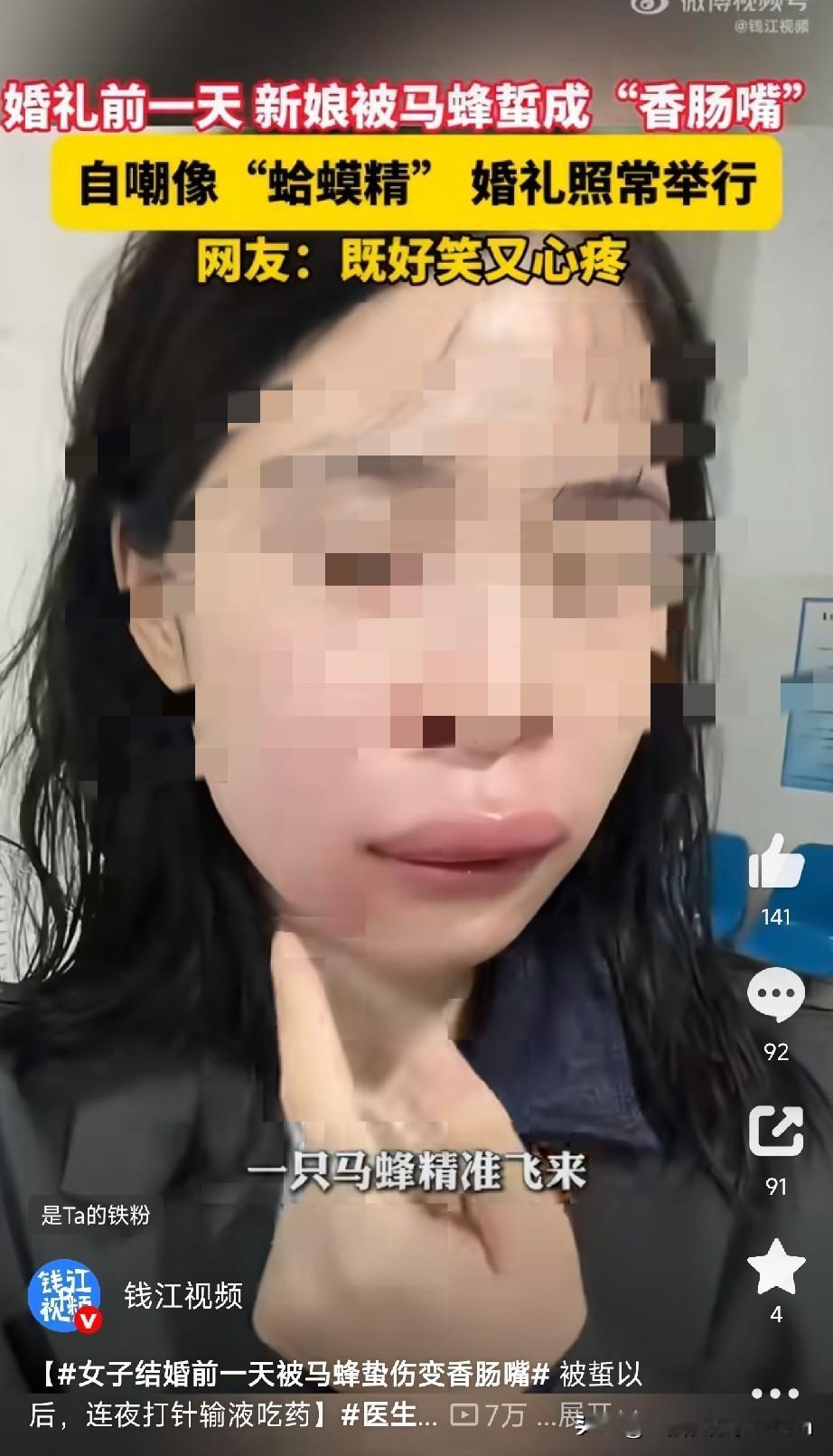 医生提醒：被马蜂蜇了，多数不留刺；若有残留，用银行卡、身份证等硬片平行刮掉，或用