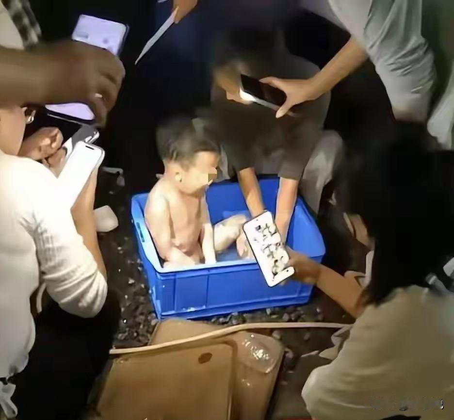四川攀枝一餐馆内，男童不慎掉进炭火堆，母亲徒手救出。钟宇全身85%烧伤左手手指基