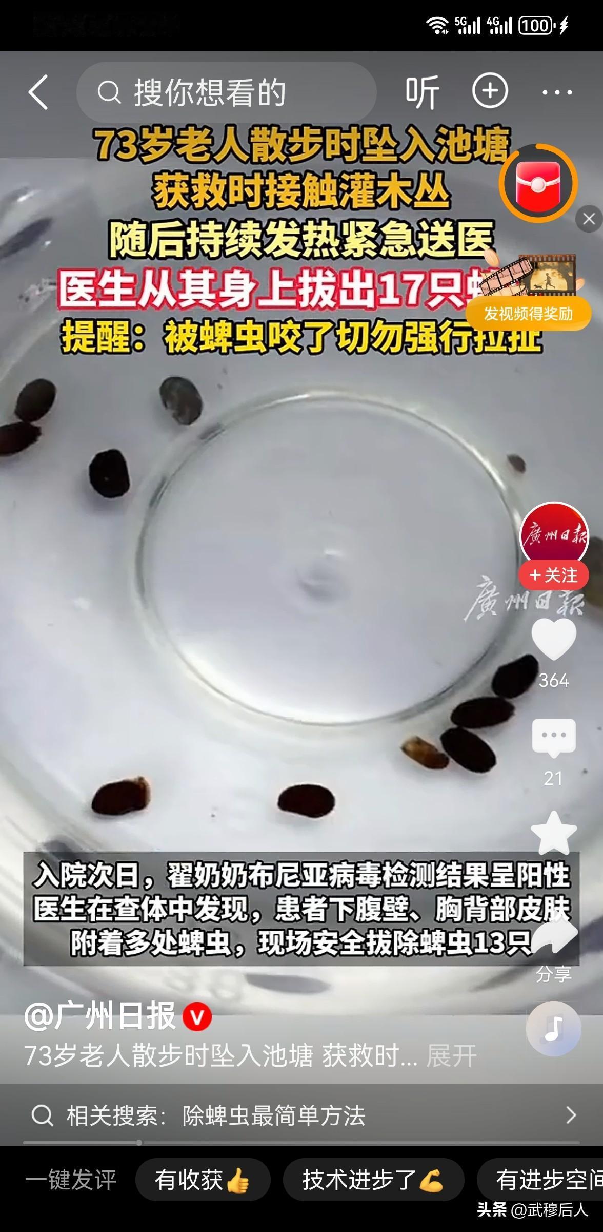 惊心！73岁老人身上爬满17只蜱虫，医生紧急拔除：这个“隐形杀手”，千万别大意！
