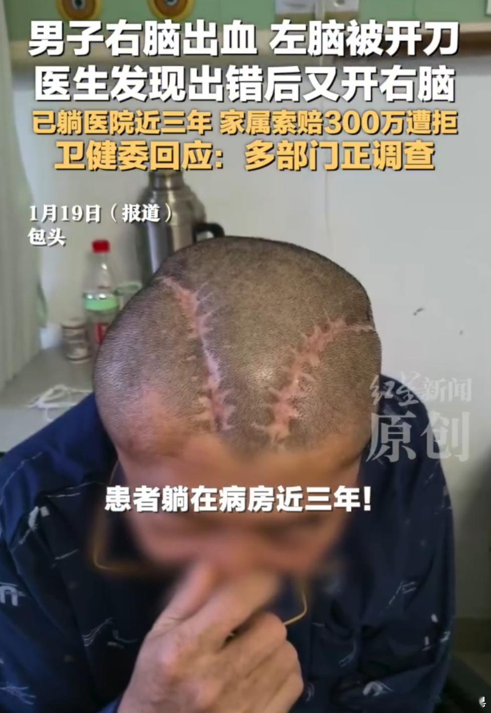 男子右脑出血被医生错开左脑 这就是纯纯的医疗事故……医院就是要承担责任。家属索赔