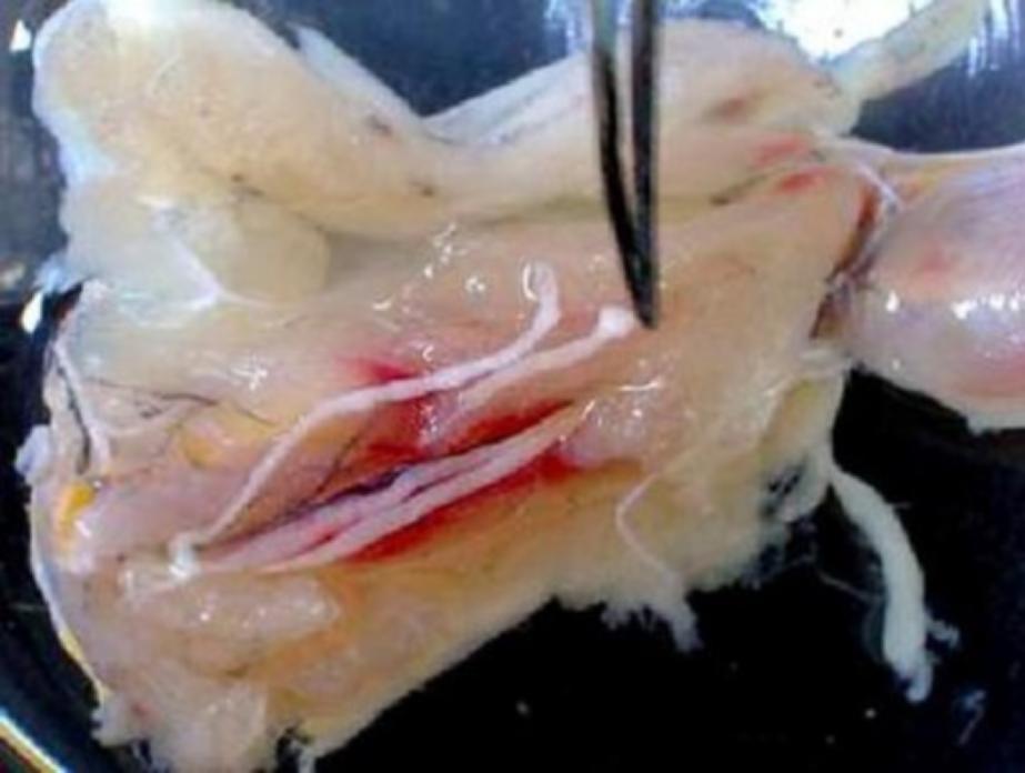 降温了，这样吃火锅等于“吃虫”！广东疾控提醒