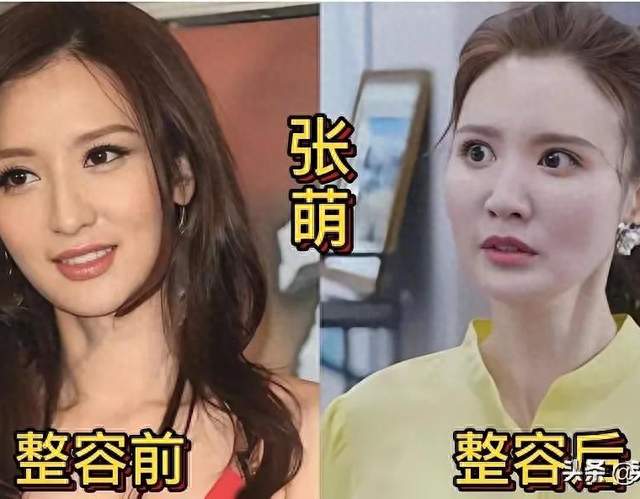 《张萌、柳岩整容前旧照曝光！网友：完全认不出，差距太大》