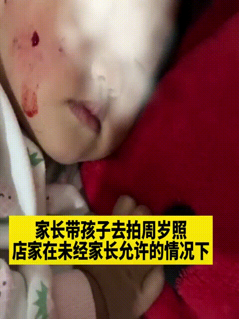 孩子拍周岁照，店家没有和孩子母亲商量，化妆师给孩子涂抹了粉底，导致孩子过敏，脸部