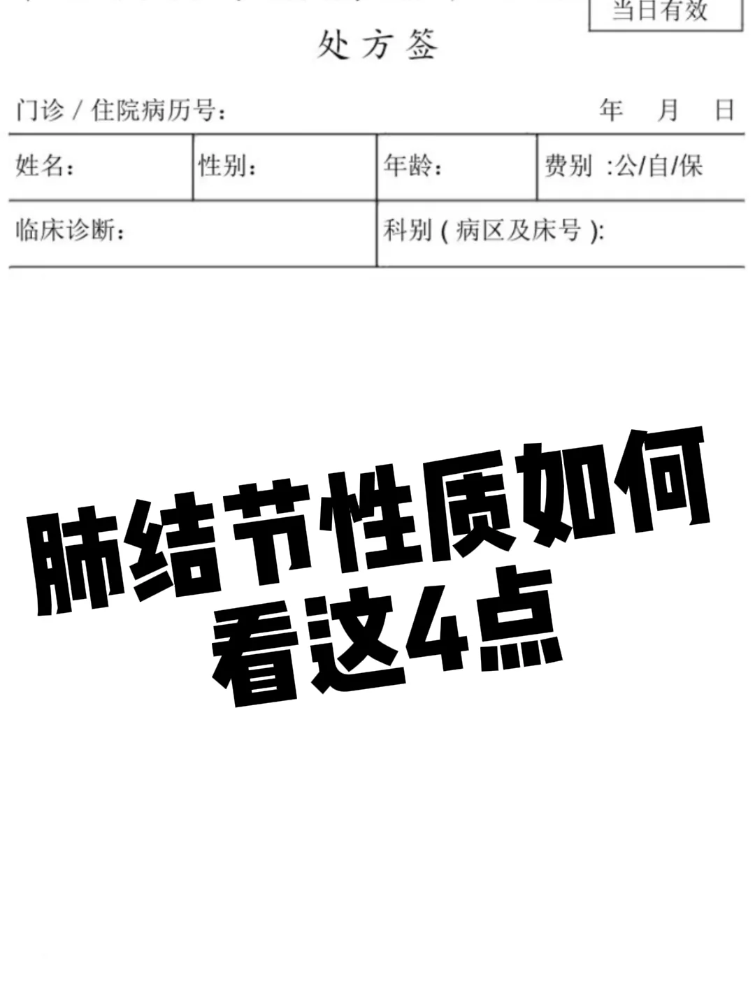 肺结节性质如何看这4点