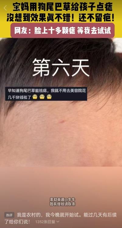 惊人奇效！狗尾巴草神奇去痣，宝妈亲测孩子脸上痣迹消失[玫瑰]

这听起来匪夷所思
