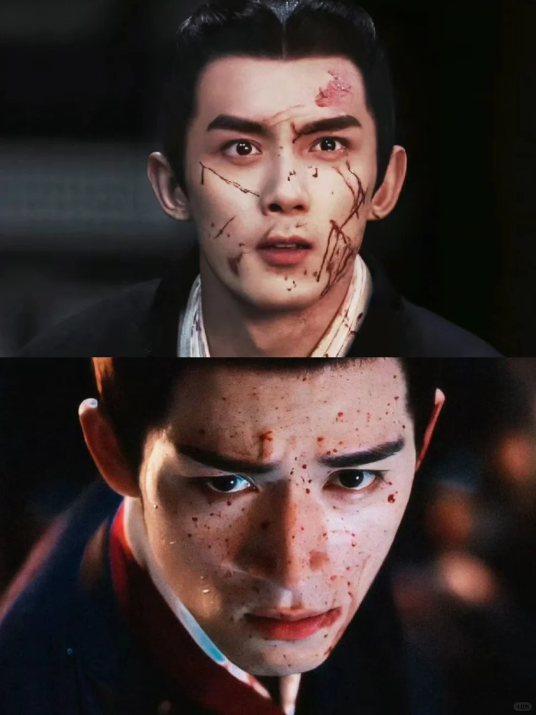 上一个满脸的血吸引我的还是他