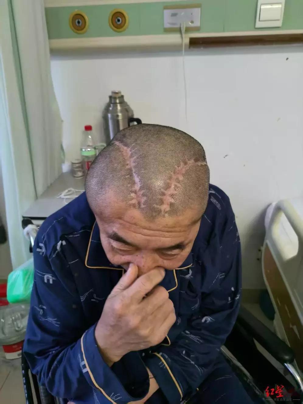 男子右脑出血却被开左脑，发现出错又开右脑，这妥妥是医疗事故啊！在医疗领域，精准诊