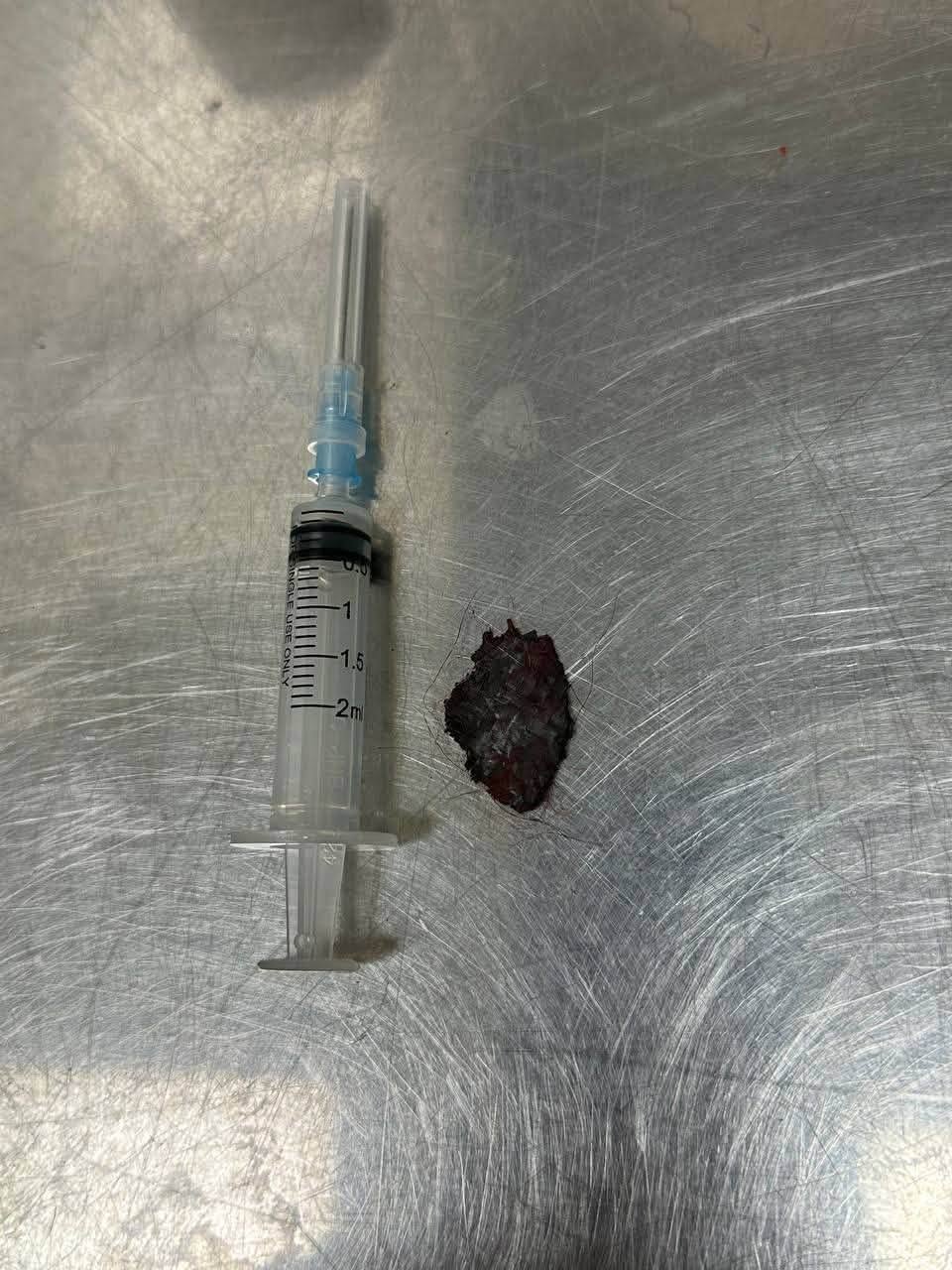 一对夫妻从库皮扬斯克逃到了哈尔科夫，但还是没能逃过俄军的空袭，妻子当场遇难，丈夫