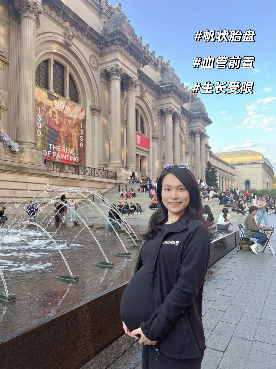 单绒双羊32周｜预约了2周后剖腹产