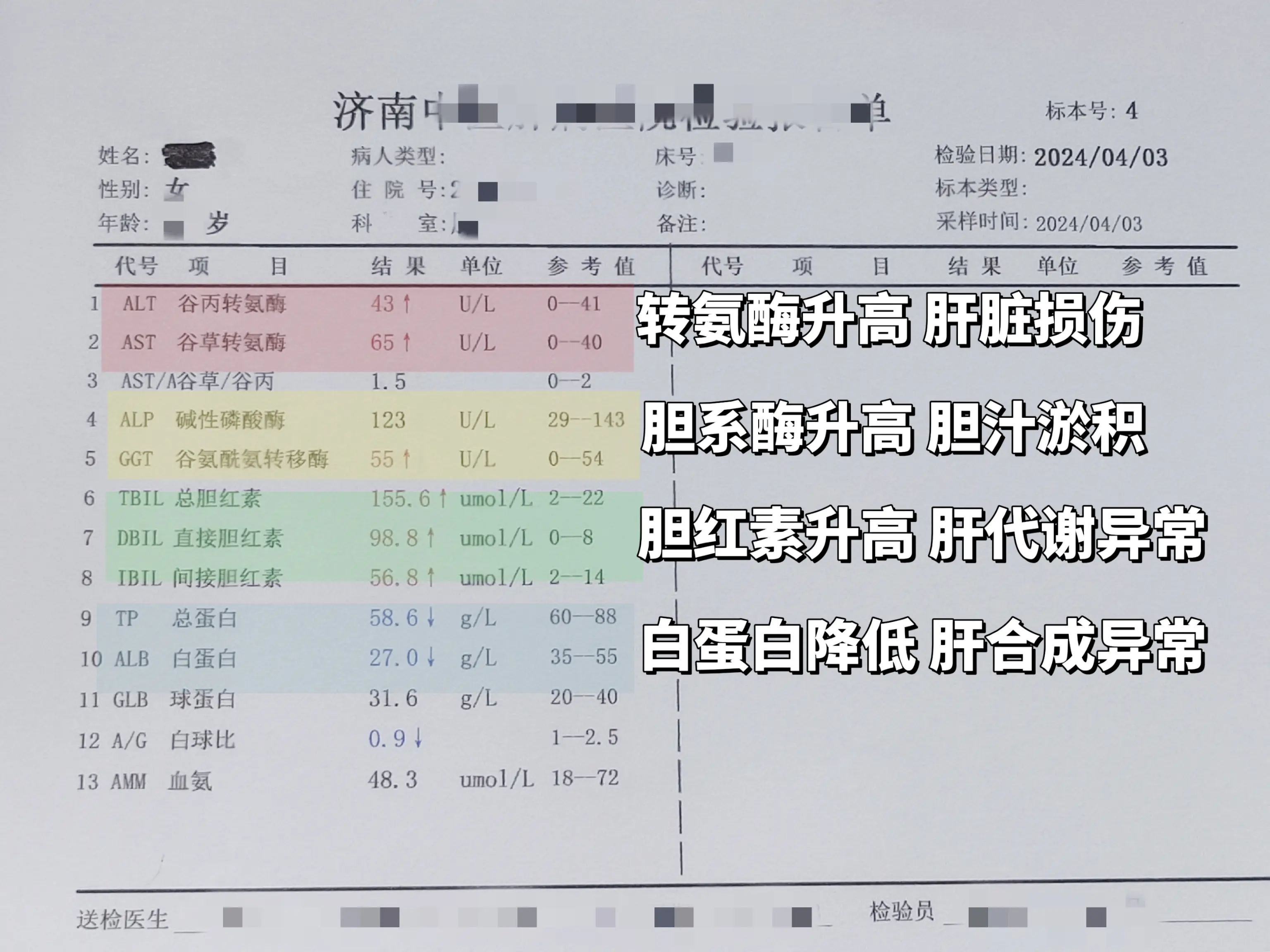 肝功能 医学科普 山东 肝病
