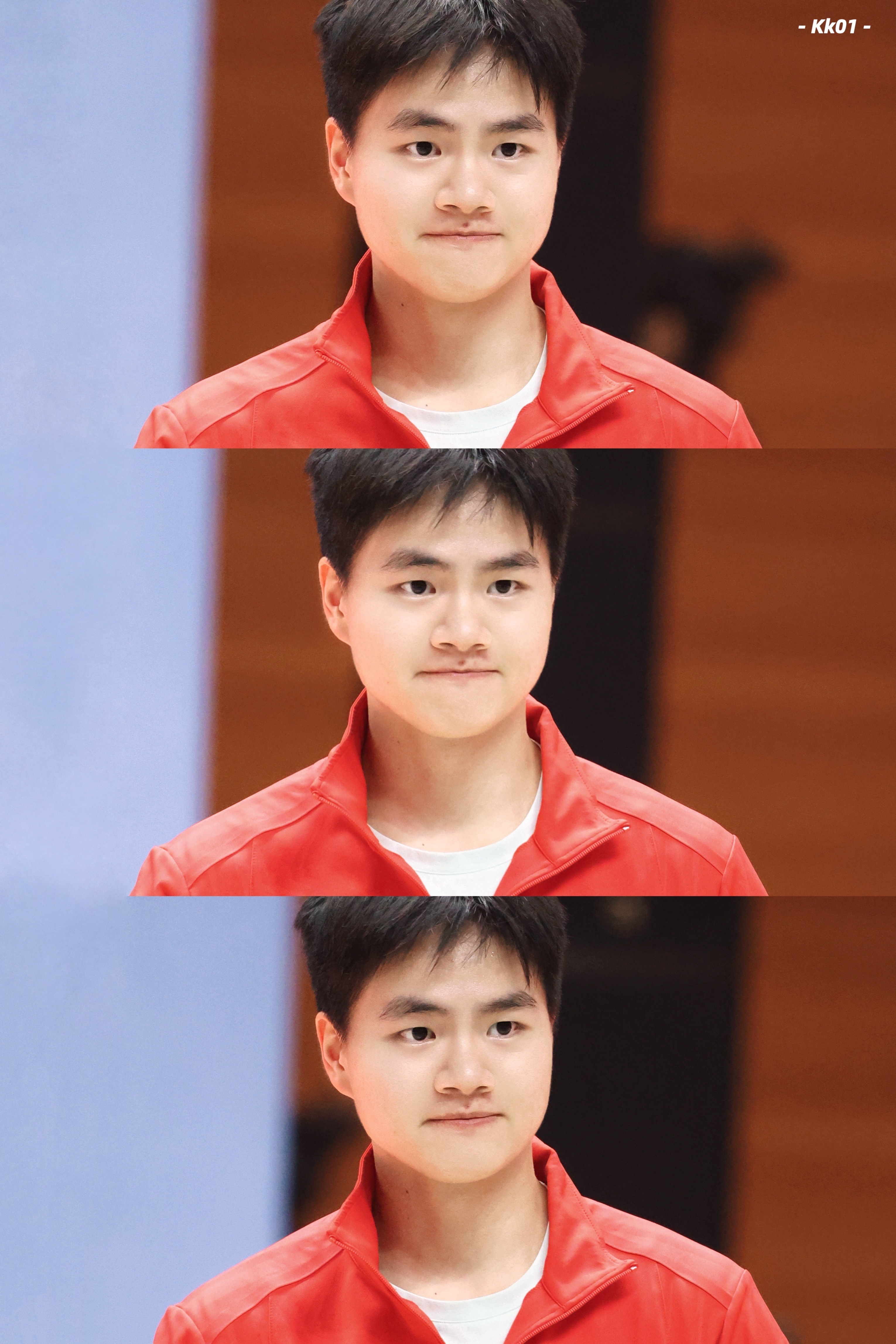 宝宝也太美了…… 精神兴奋➛交感神经传导➛释放去甲肾上腺素➛虹膜辐射肌动作点位➛