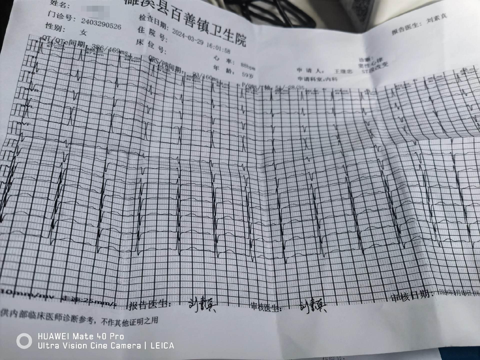 冠脉CTA示血管没有狭窄！这些药不要吃！没明确之前不要乱吃药！这是对患者和医生的提醒！在门诊经常有患者在没明确之前说：医生，你给我开点药吃吃！