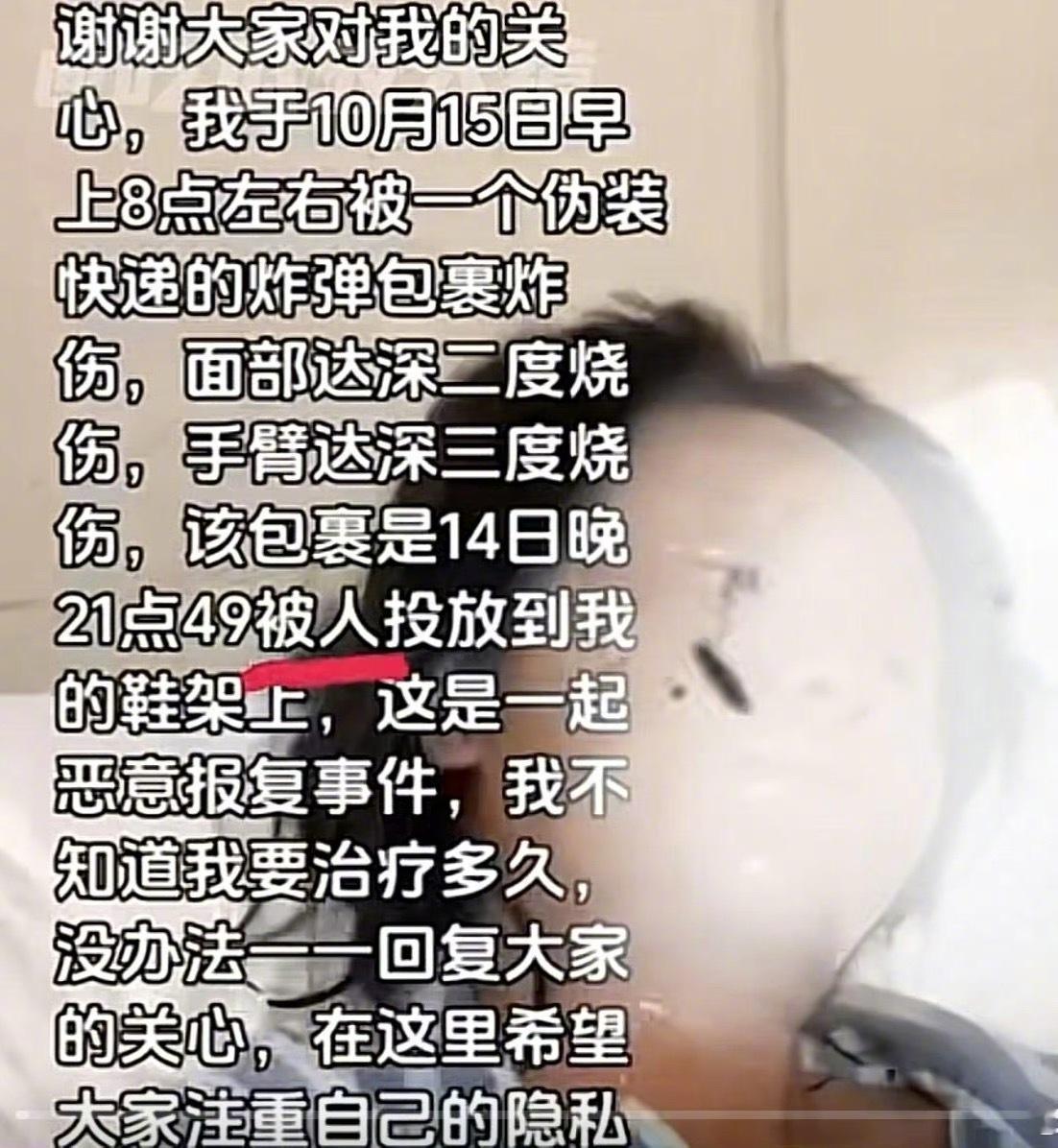 湖南一女主播收到炸弹包裹被炸伤大家一定要注重自己的隐私，这样的事情太恶劣了！那个