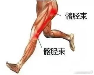 膝盖疼痛 【膝痛康复】膝盖侧面总是不舒服，可能有哪些损伤风险，来帮你详细分析👇