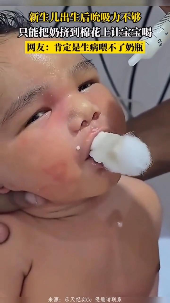 新生儿出生后吮吸力不够，只能把奶挤到棉花上让宝宝喝。网友：肯定是生病喂不了奶瓶。