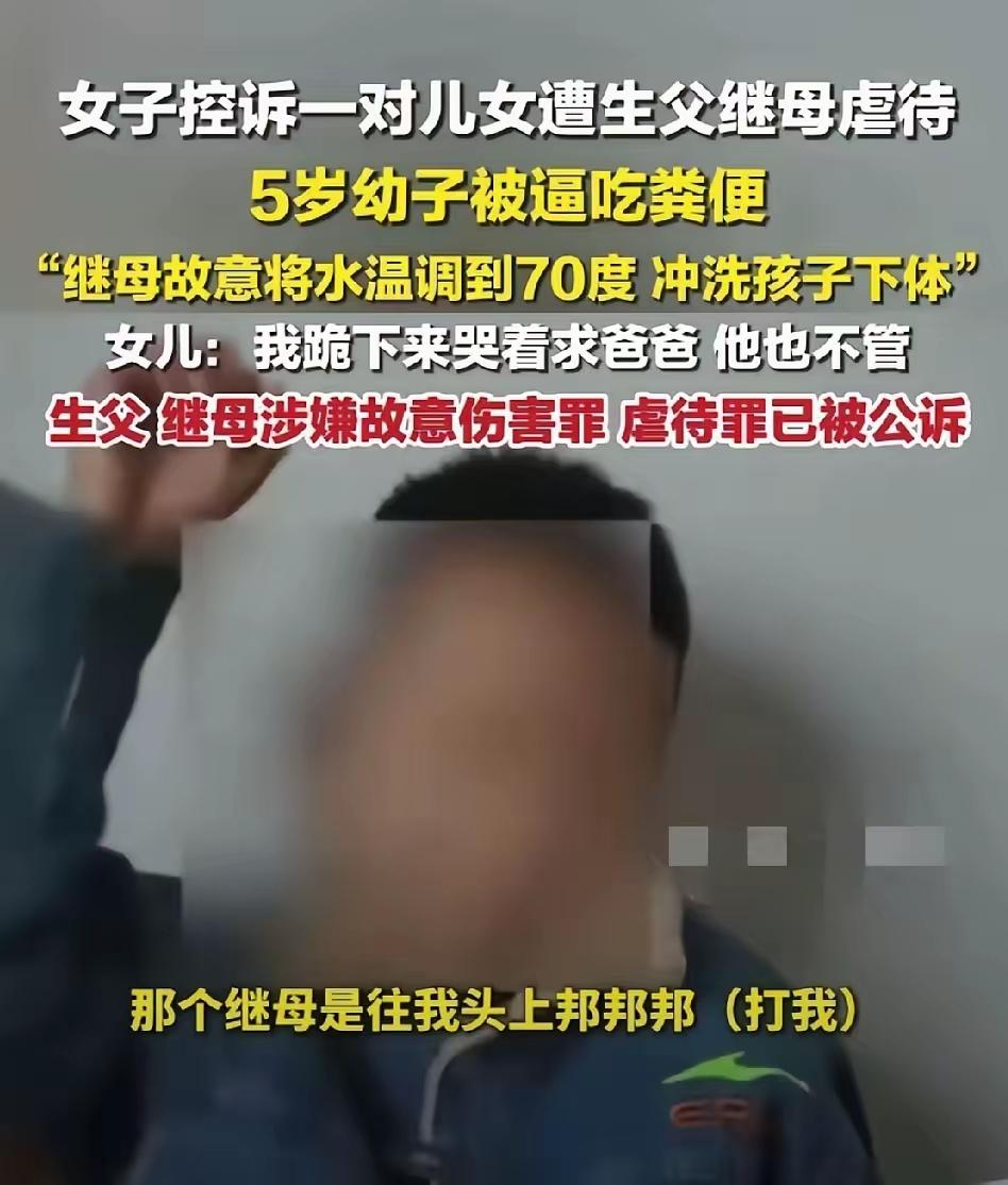 又是继母联合生父虐待孩子的恶性事件，看得人无比愤怒，这人心肠怎么能恶毒到这种地步