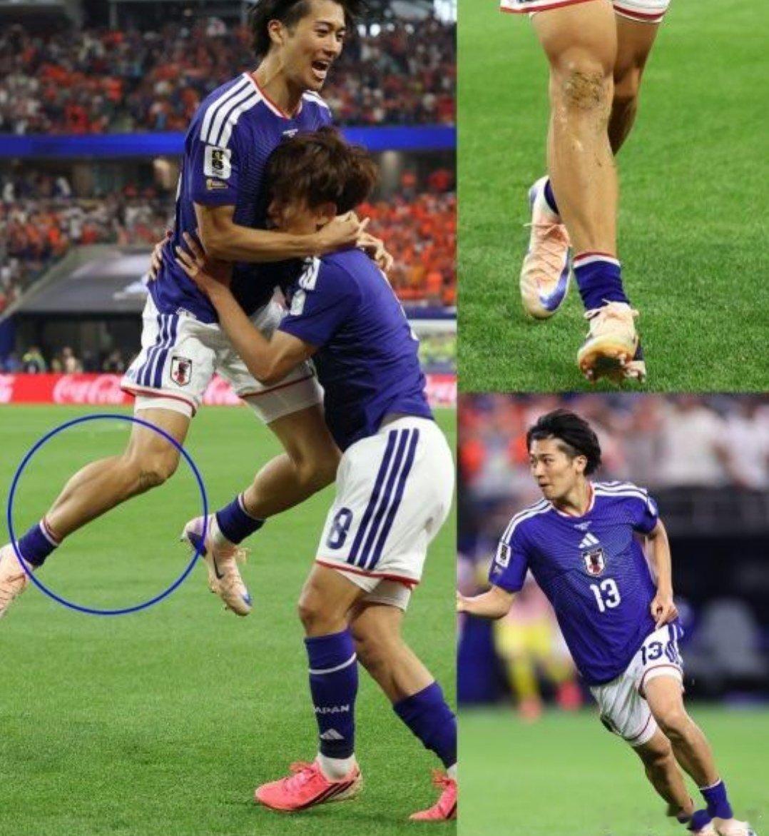 热议炸锅！日本国脚比赛“不戴护腿板”？真相曝光：不是违规，是为了保命才这么干！在