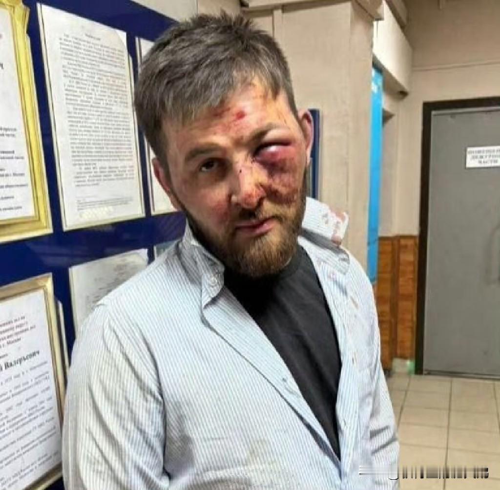 这个猪头，是那段轰动全球社媒的视频中出现的团伙成员之一，这个俄自由媒体口中所谓的