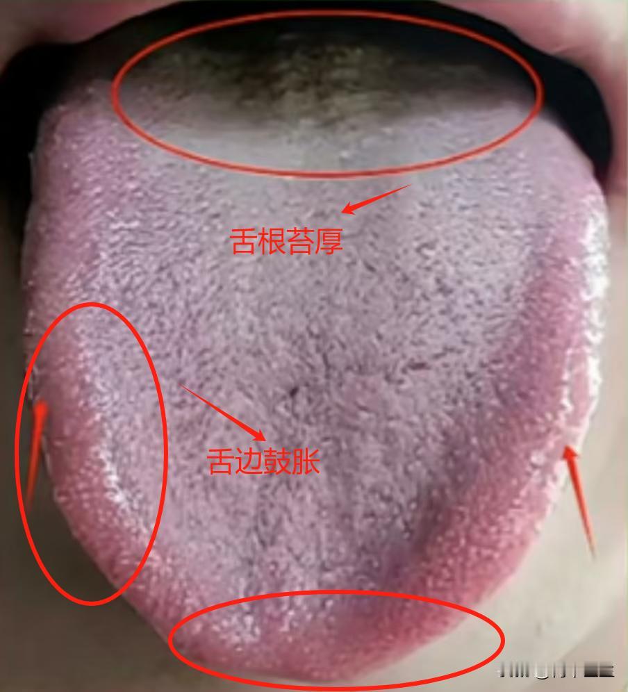 肾虚用桂附地黄芄没用？其实答案都在舌头上，看完就知道自己这样做是在犯傻了

主诉