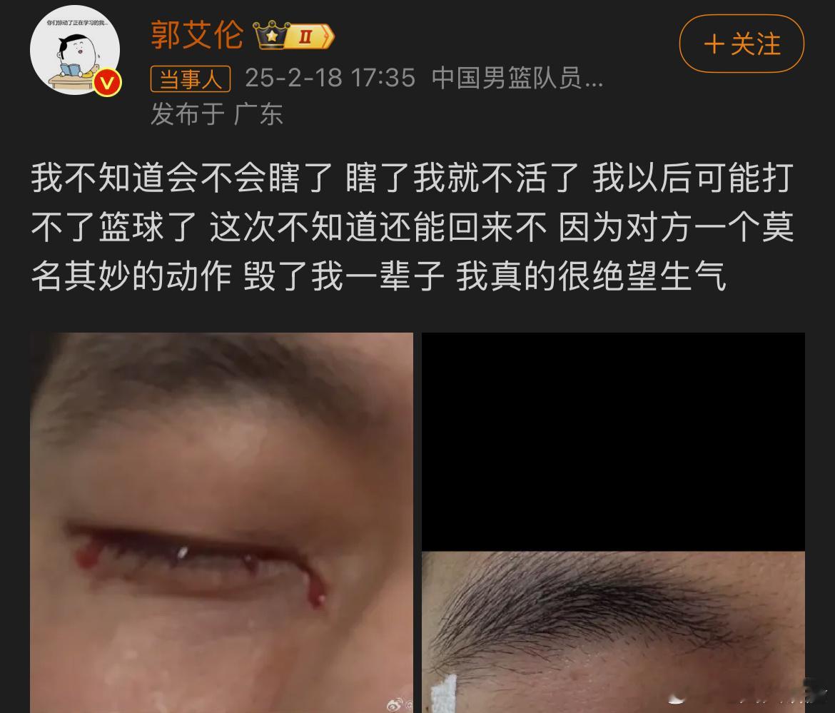 郭艾伦在社交媒体中发布：自己亲身经历过网暴，知道那滋味不好受，所以想保护伤到他的