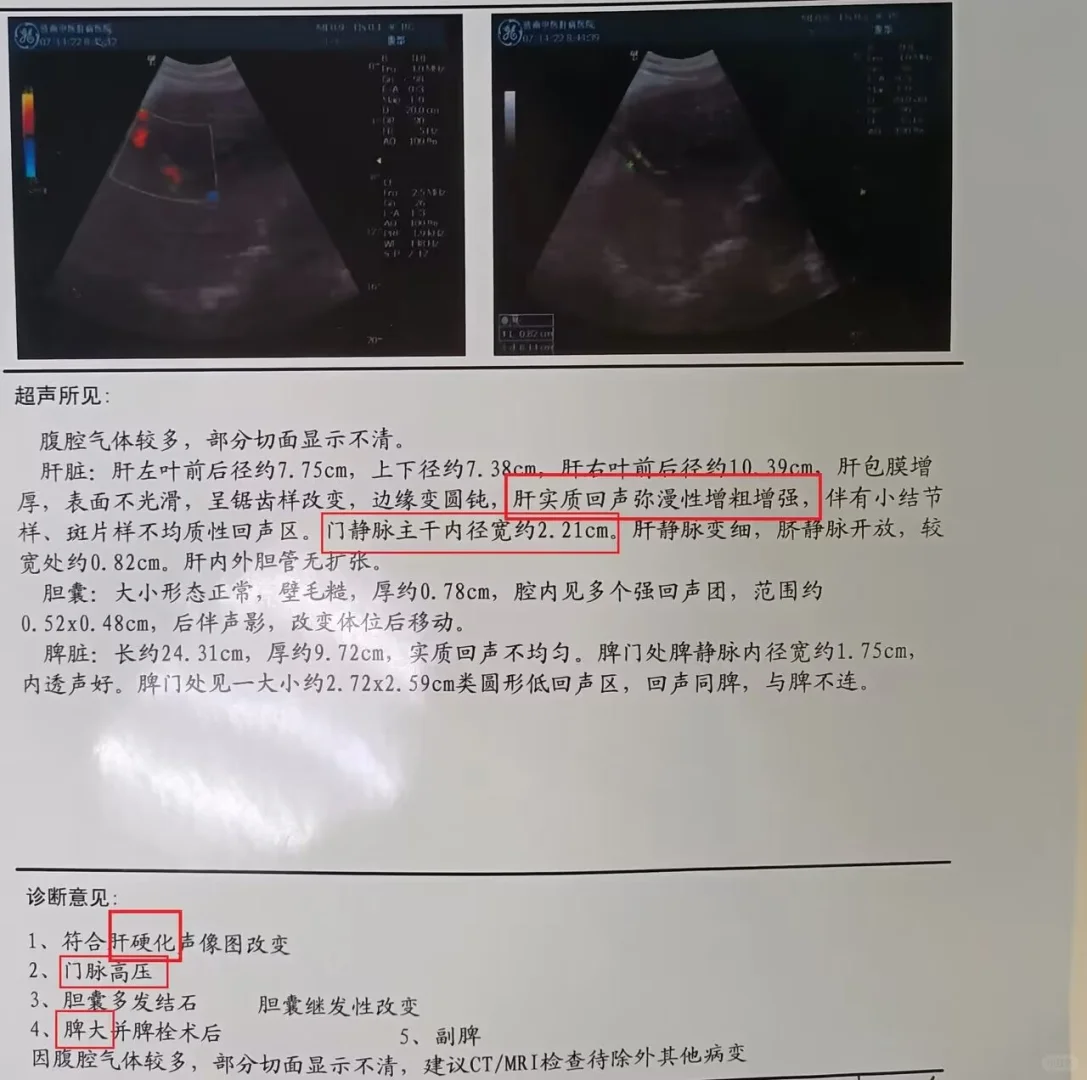 很难想象这是同一位患者的报告单！