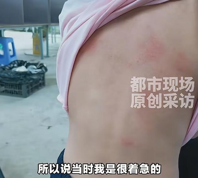 一个5岁的小女孩因为过敏去看急诊，医生不光不给看，事后还摸进全省联网的电子病历系