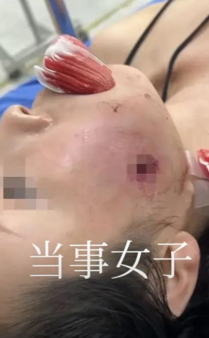 真的是太吓人了。东方大国一对母女去泰国普吉岛旅游，刚站定想拍几张照片。结果只听见