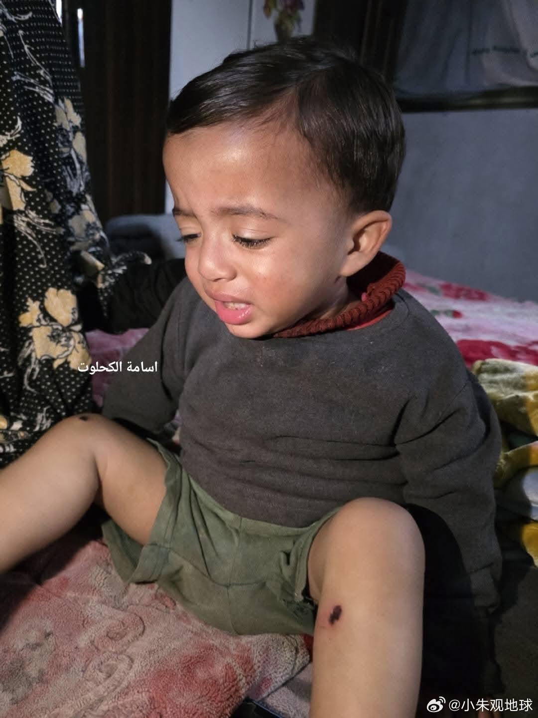 以军对18个月大婴儿施酷刑 据外媒报道，以色列士兵在加沙中部对一名1岁幼童实施虐