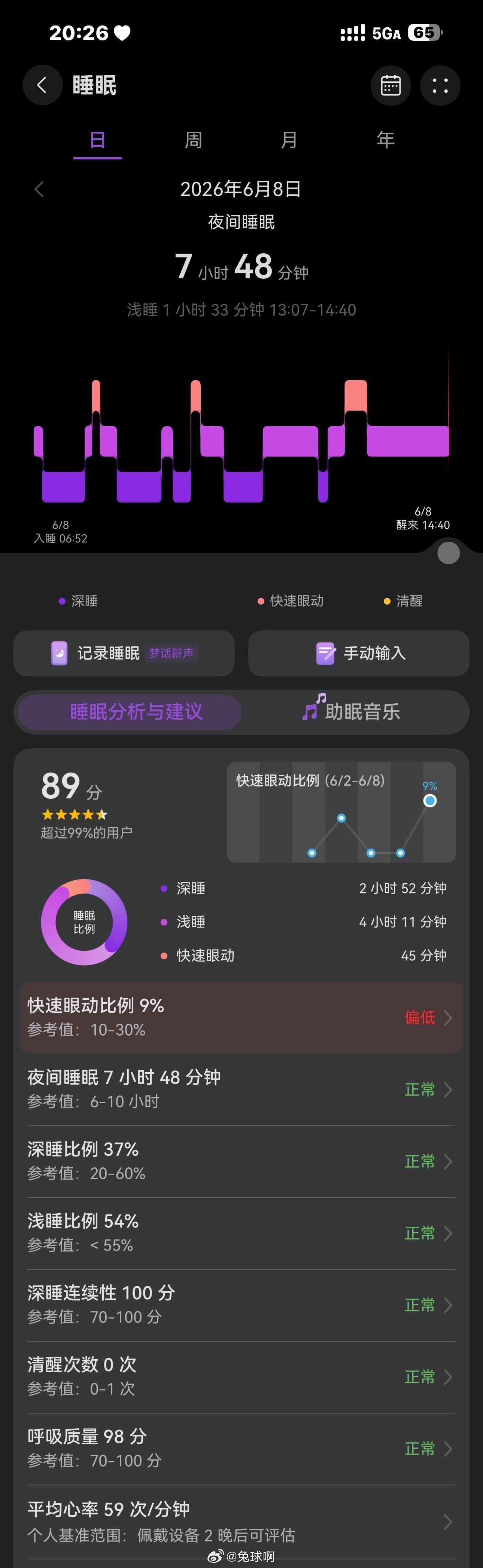 这个快速眼动是啥，我一直这个数值很低，这是指做梦的时候吗？ 