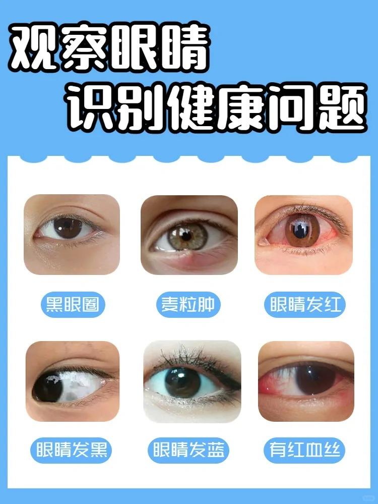 经常玩手机、面对电脑，📱甚至熬夜，深夜关着灯玩手机，👀这样对眼睛的伤害是很大