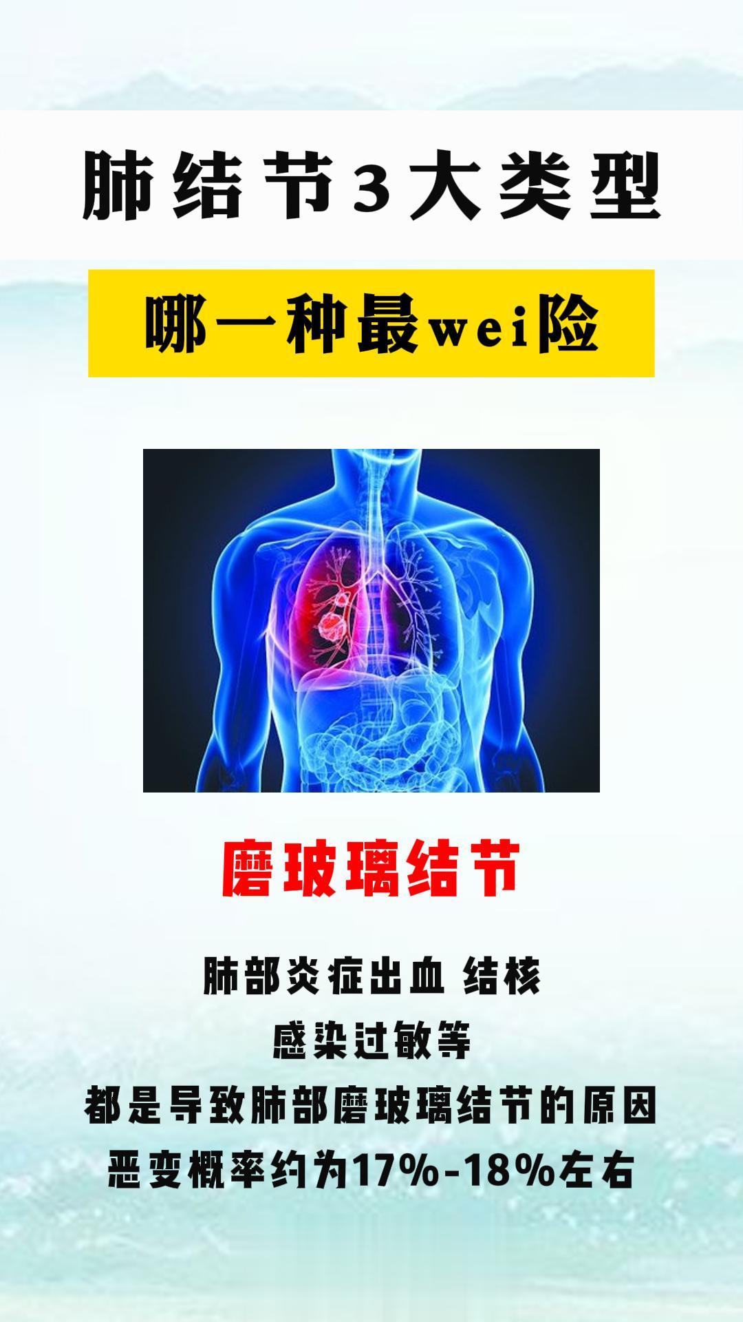 肺结节3大类型 哪种最危险。