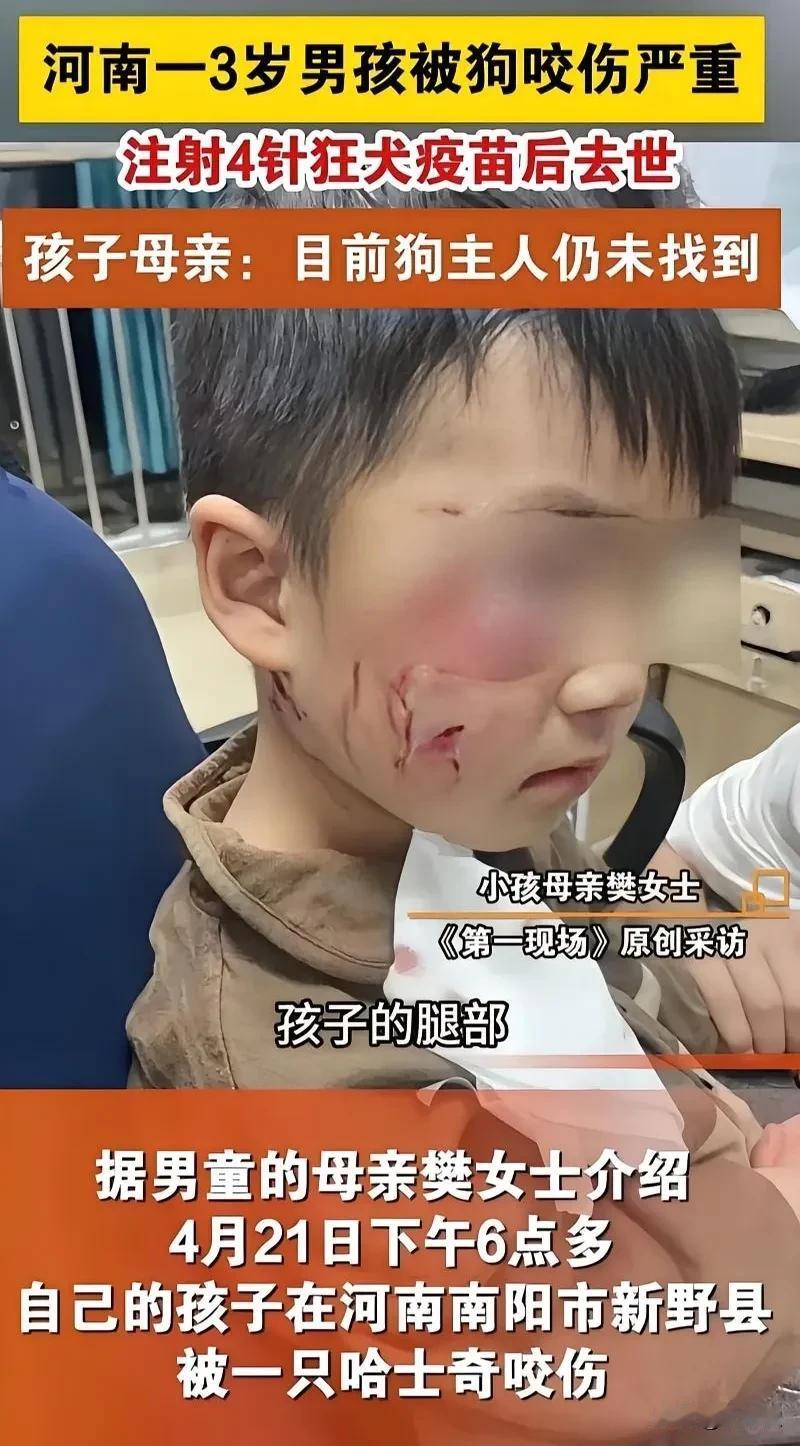 暑假孩子们都在家，一定要看好孩子，因为狗是管不了的，只能管自己孩子了！
这几天高