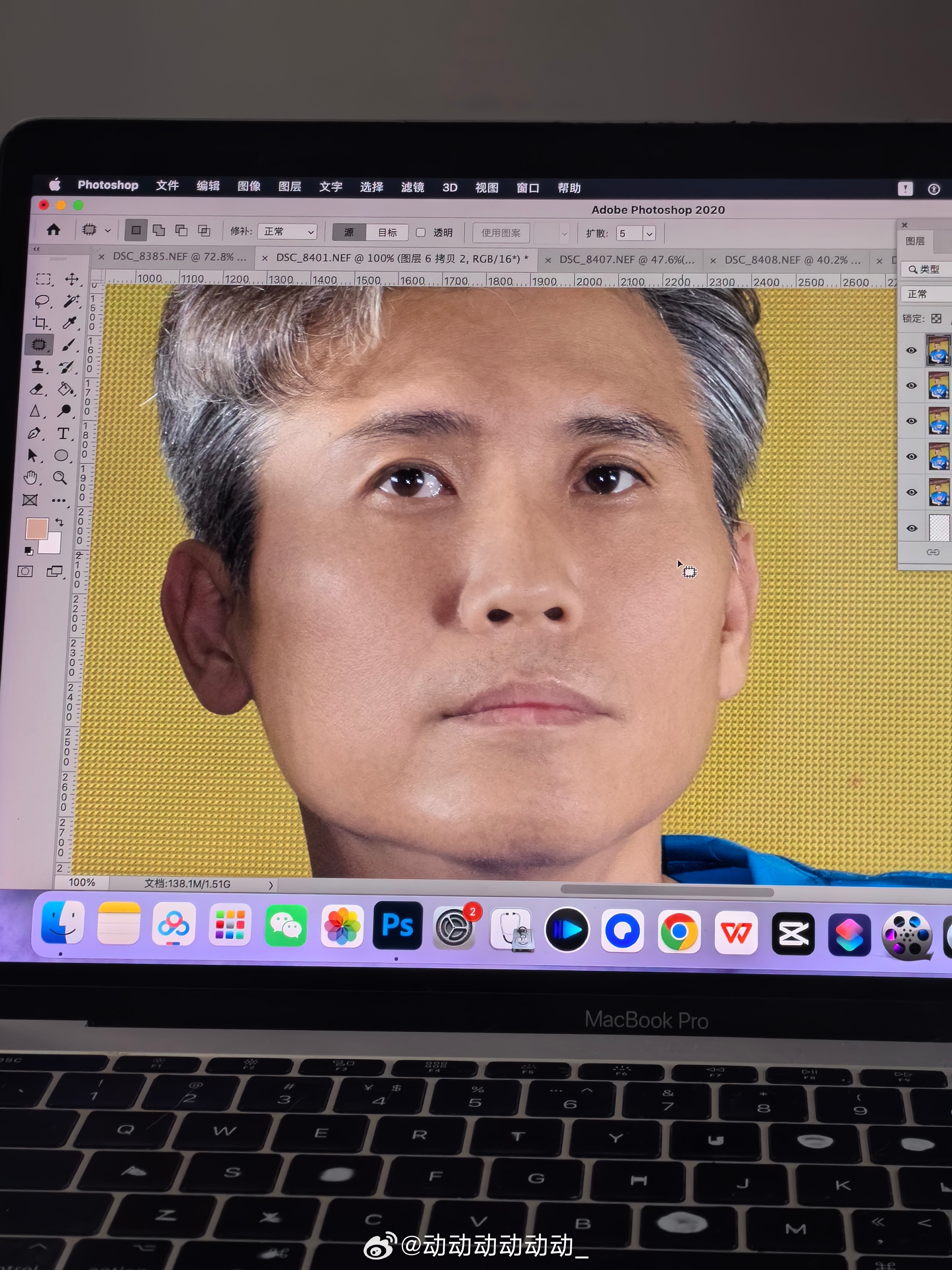 修一张就得歇一会儿颈椎肩周后背疼胯骨轴子为什么也疼呢