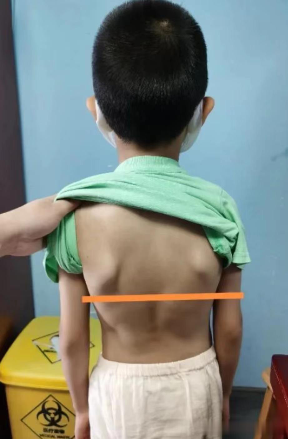 孩子不长个不长肉，不过是脾“漏”了，补得再多也没用
 
[快哭了]真心疼！这个6