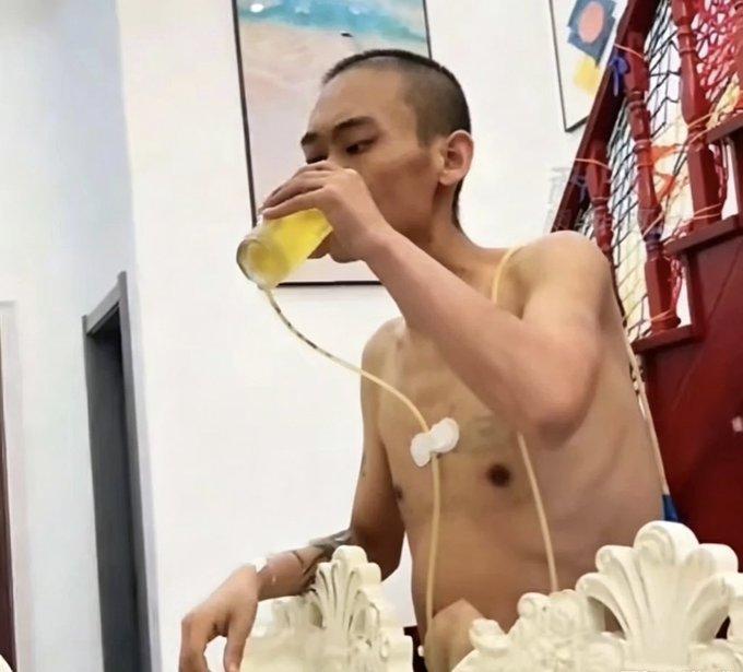 看到一个事，有个肝癌晚期的男子，放弃治疗后买了箱啤酒。他光着膀子插着管子，对着啤