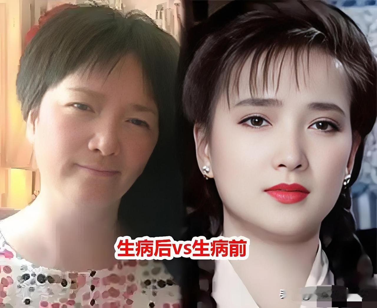 吓哭了，比何晴突然去世更震惊的是，她病前病后的变化之大，简直认不出是同一人！
