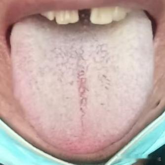 别盲目进补！科学辨证调养，让宗筋慢慢坚实有力






很多男同志到了一定的年