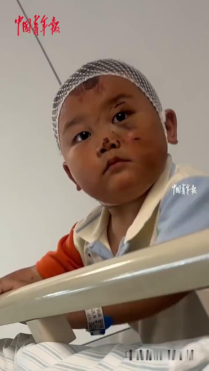 母子发生车祸，3岁男孩在医院守护妈妈寸步不离。
中国青年报。
近日浙江衢州，当事