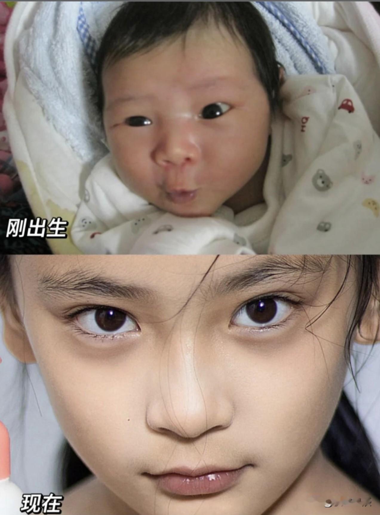 在家没事翻看之前的照片，刷到了外甥女刚出生时的照片，我自己看了都想笑
塌鼻子肿眼