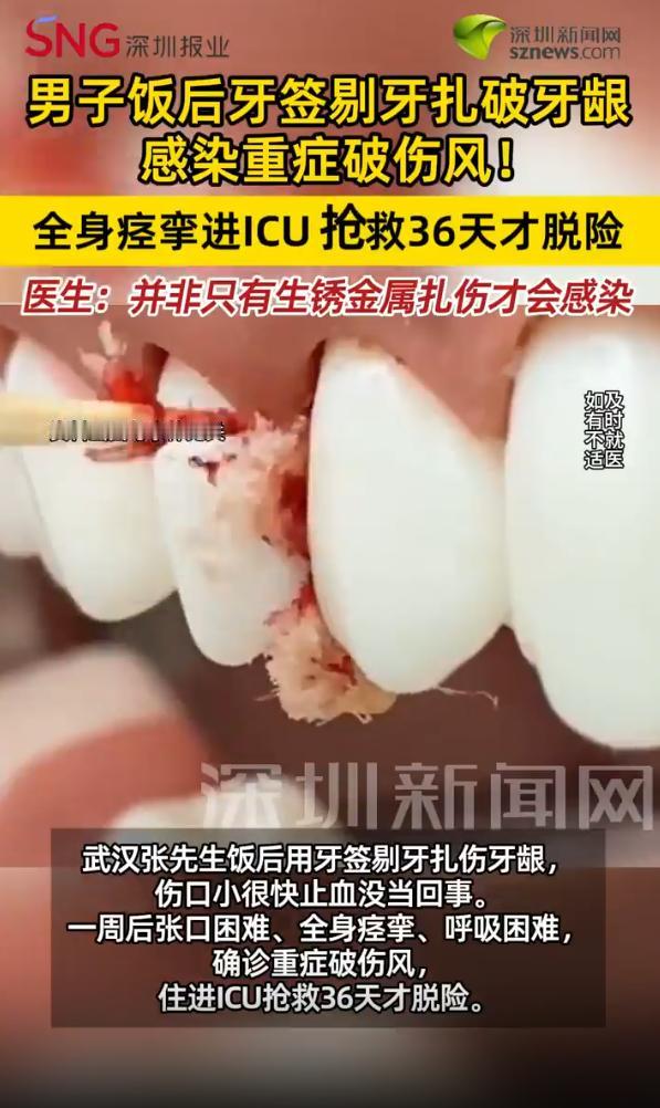 悲剧还是发生了！湖北武汉，一男子饭后用牙签剔牙，不料竟扎破牙龈致细小伤口出血，起