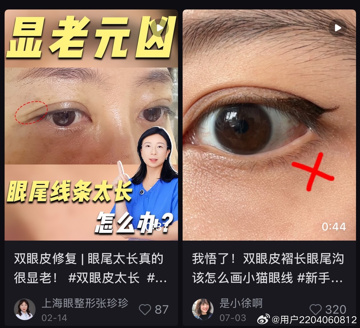 给准备开蒜皮的uu一个提醒！（或者是思路。这个是我单眼皮的时候完全考虑不到的。就