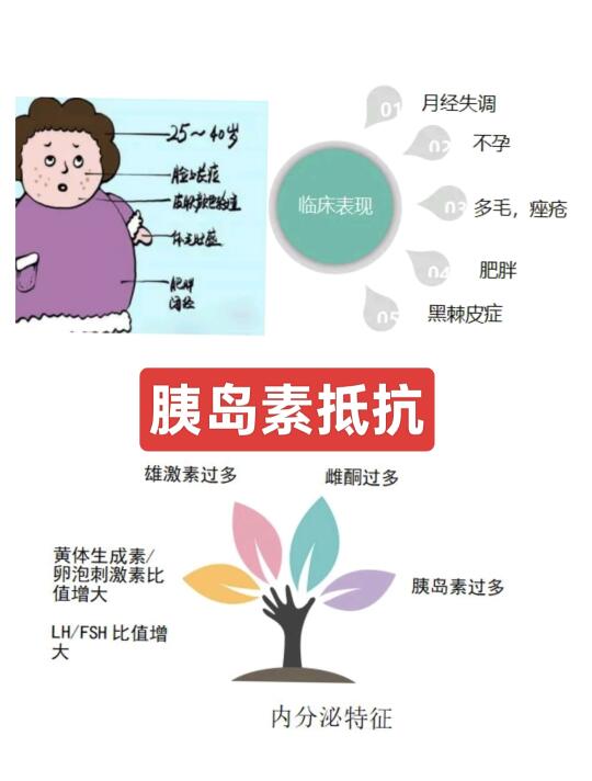 关于“胰岛素抵抗和备孕”的回复