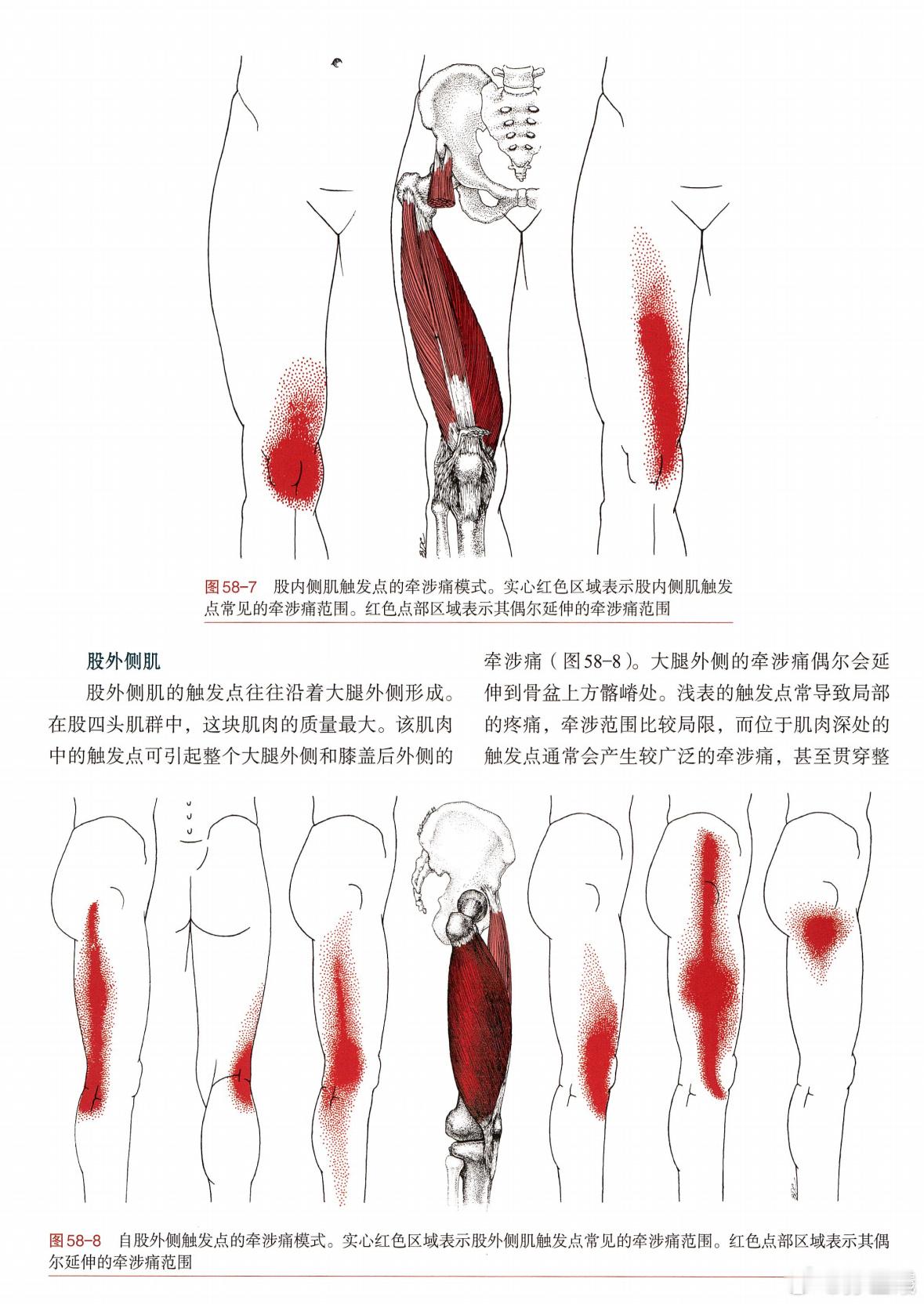 寒假在解决这个问题，大腿侧面紧张和疼痛，找到原理. 