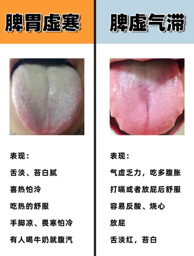 脾虚的不同表现，一张图教你看懂自己的问题