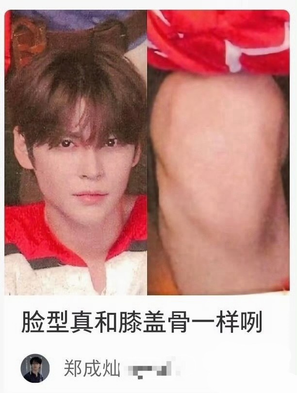 郑成灿粉丝也在羡慕宋银硕的小头小脸吗？ ​​​