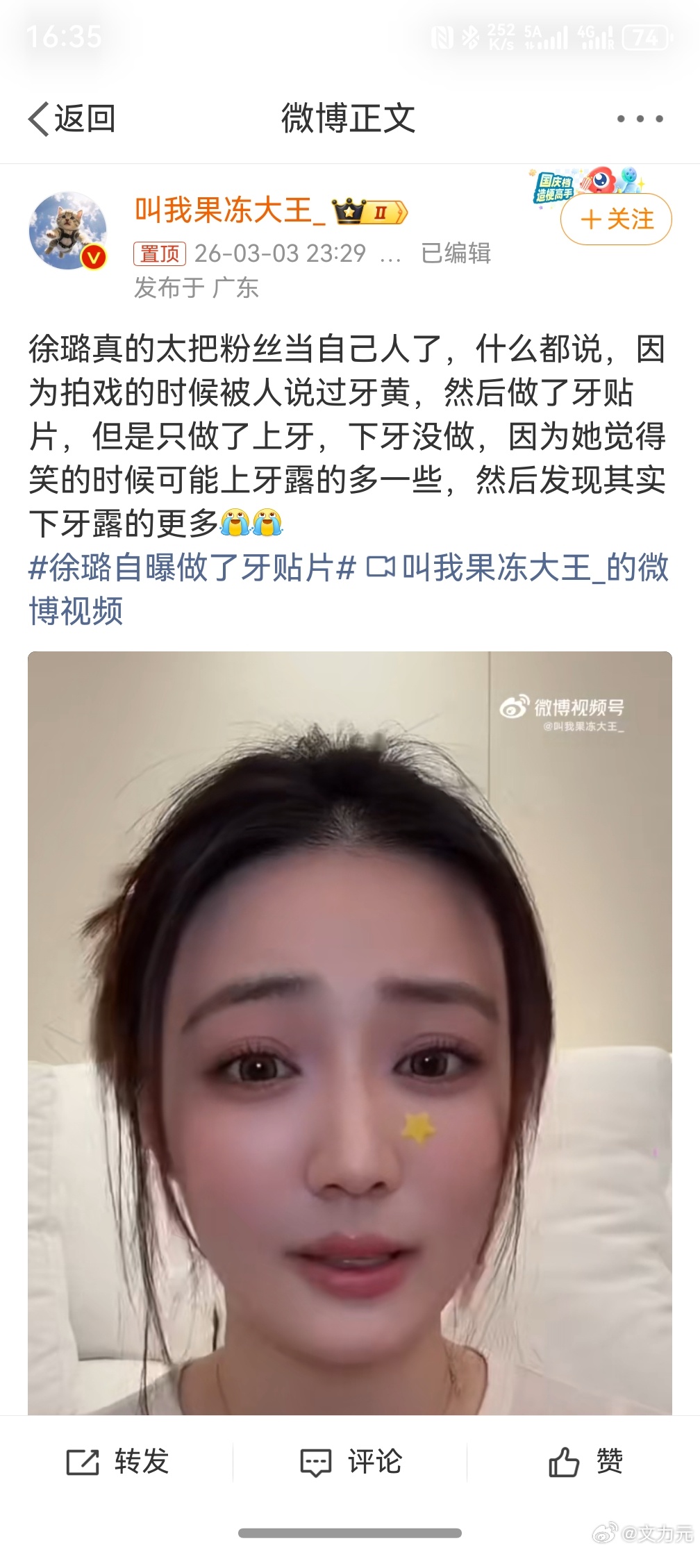 徐璐自曝做了牙贴片，其实我也想做牙贴片，从小羡慕别人一口白牙，但是总觉得技术不成