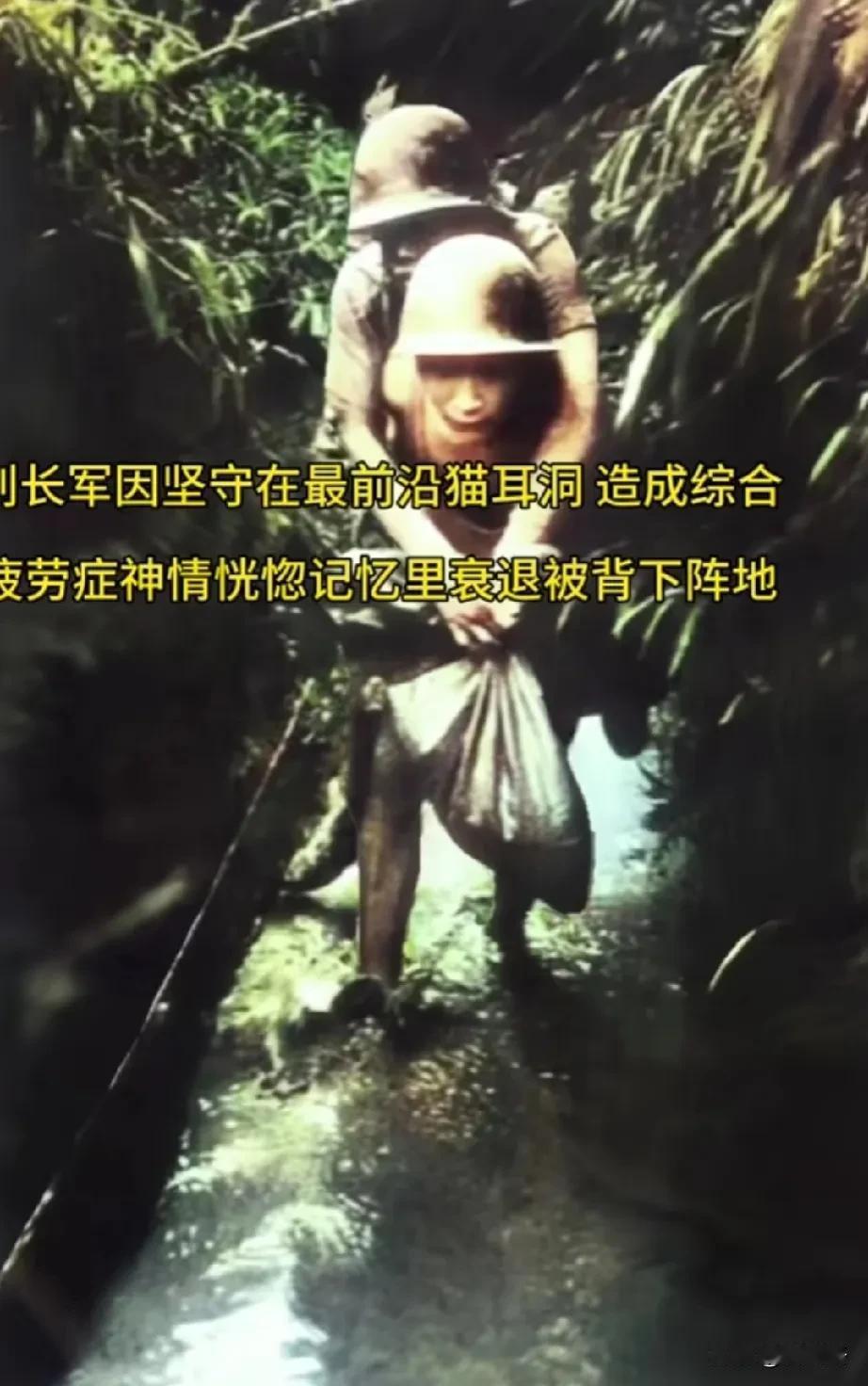 令人心疼的一幕！年轻战士背着患综合疲劳症的战友走出猫耳洞！
1985年6月，七连
