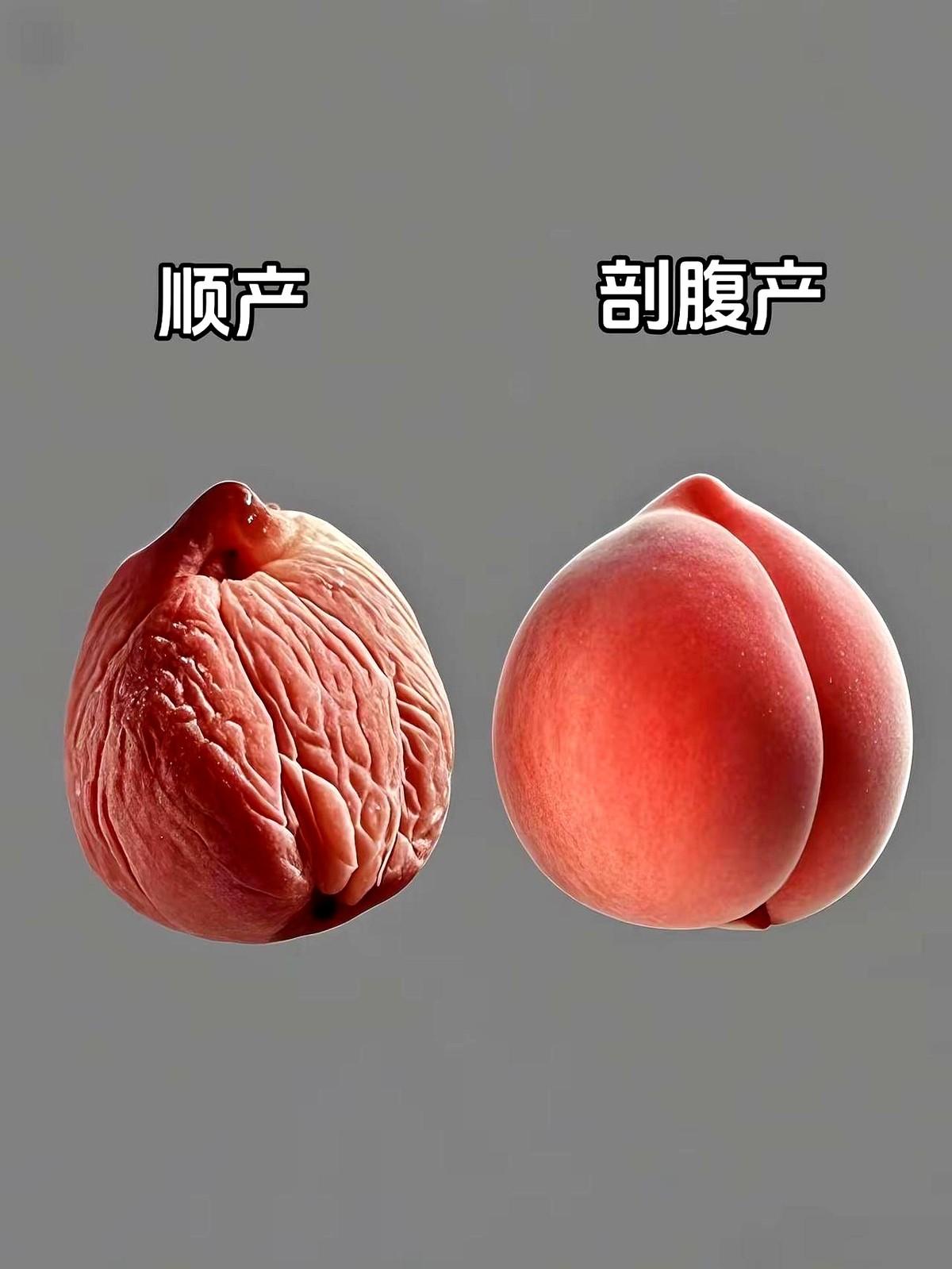 终于知道医生为啥都劝能顺就顺！

你觉得是剖腹好还是顺的好呢？

之前听产科朋友